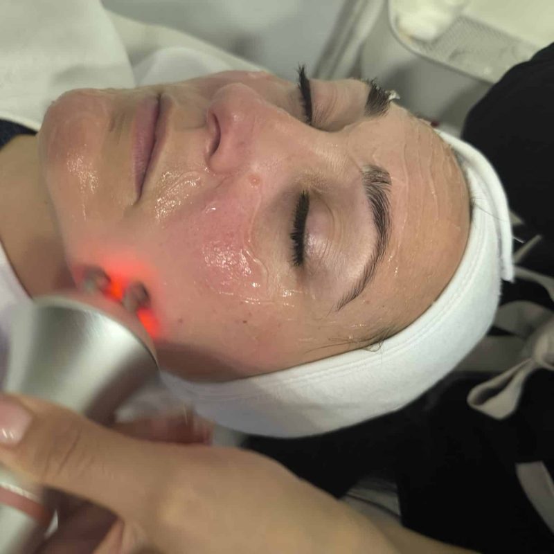 Higiene facial + radiofrecuencia tripolar