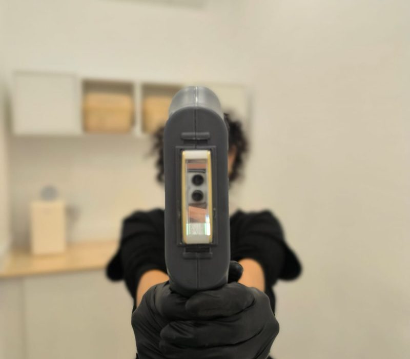 depilación-láser-sevilla